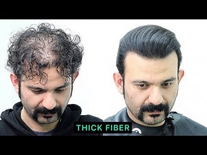 Bald & Thinning Hair Transformation l Hair Fiber powder