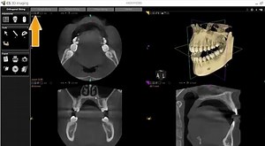 CS 3D imaging software basic tutorial #Carestream