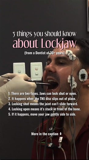 Lockjaw can happen when the jaw locks shut (unable to open) or open (unable to close). Both occur when the joint isn’t tracking properly, usually because the internal disc has shifted out of place. Locking open is the jaw getting stuck in front of the Articular Tubercle Bone. If lockjaw happens, stay calm and never force the jaw open or shut. Try gentle side-to-side movements and apply a warm compress to relax the surrounding muscles. If the joint doesn’t release or if locking happens often, see