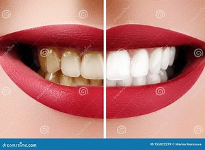 Dental Smile Design Software Free Download