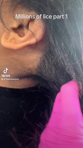MILLIONS OF LICE REMOVED PART 1 #theliceangels #piojos #lice #hair-goals #corpuschristi #corpuschristitexas #liceremoval #tiktokviral #famous #texas #weship #WeShipWorldwide #UpdateNews #givingback #givingbacktothecommunity | The Lice Angels