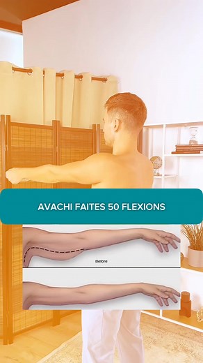 🔥 🔥 BRAS FLASQUES ? BOSSE DE BISON ? ESSAYEZ CE COMPLEXE MAGIQUE ! 💪 Ce n’est pas une question d’âge — mais de posture et d’équilibre. Ce complexe magique va : ✨ tonifier vos bras ✨ lisser la “bosse de bison” ✨ redonner de la légèreté et de la confiance à votre corps 🙌 LAISSEZ 🔥 SI VOUS VOULEZ LA TECHNIQUE POUR UN VENTRE GONFLÉ 👇 #posture #exercice #bienêtre #faceplasty #santé | Dr. Ales Ulishchenko French