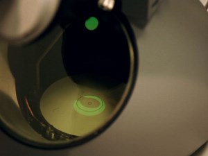 Visualization of Endoplasmic Reticulum Subdomains in Cultured Cells