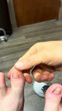 Reattachment of toenail to the nail bed with laser therapy, Dr. Stewart at TFAC