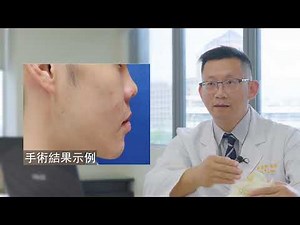 【顏博士專訪】臉型歪斜、咬合異常、呼吸道狹窄 正顎手術都能改善！看懂手術適應症＋3D列印怎麼幫上忙 | 長庚醫院 廖漢聰主任