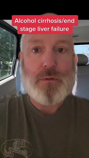 #alcohol #cirrhosis #fyp #fypシ #jaundice #symptoms #liver #transplant
