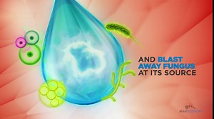 NailRENEW Antifungal - Professional Strength, Compliant Fungus Treatment for Toe Fungus, Discolored or Brittle Nails (1 Bottle)