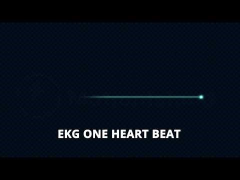 ECG Animation - After Effects