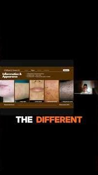 Inflammation Looks Different by Skin Tone #substack #shorts