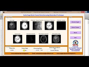Matlab code for Early Brain Tumor Detection and Classification using Watershed Technique