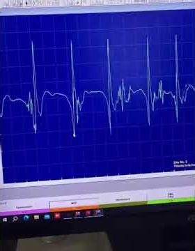 EMG in Low Back Pain: Detecting Neurogenic Damage