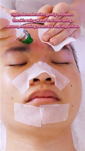 How Hydrodermabrasion Works to Reveal Brighter, More Radiant Skin | Model: SR-AF1318