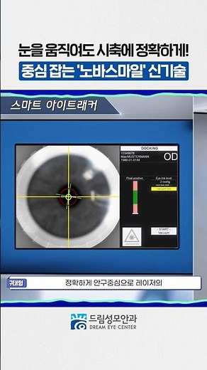 Surgery success even if you move your eyes during the procedure? Innovative technology where the ...