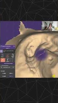 exocad Training Session - Seth Potter