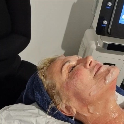 ✨ Just filmed the full HIFU Face Lift! ✨ Today I performed the complete Timeless Infinity HIFU facelift on the lovely Ruth Hartley — an incredibly experienced beauty therapist who knows treatments inside out. If she is impressed… you will be too. Watch the video to see: 🌟 Real-time lifting 🌟 Jawline tightening 🌟 Eye and cheek contouring 🌟 Instant visible results 🌟 And the science behind how HIFU works This is non-surgical, no downtime, and produces long-lasting results by stimulating deep c