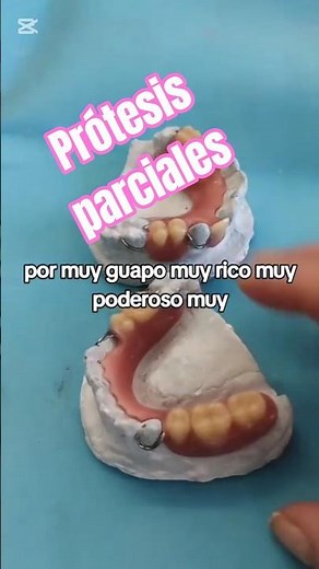 confección de prótesis parciales#curso desde cero#capacitacion dental#casos reales