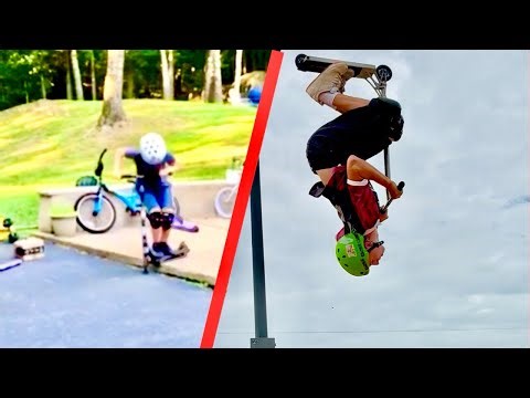 My INSANE 5 year scooter progression