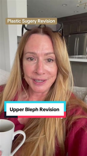 What to Expect from Upper Bleph Revision Surgery