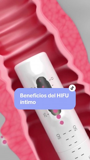 Rejuvenecimiento íntimo con HIFU: Beneficios y detalles