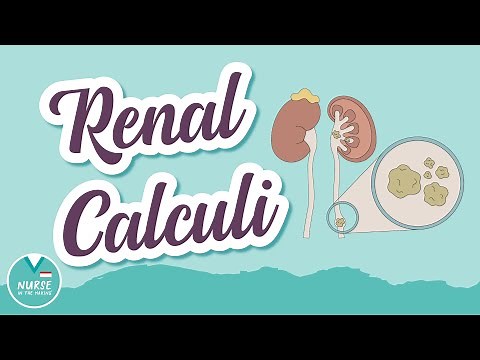 Renal Calculi AKA "Kidney Stones" | MedSurg Help for Nursing Students