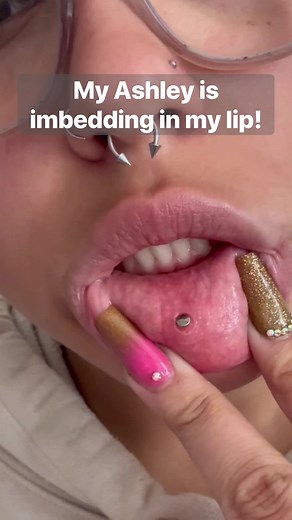 Ashley Piercing: Pros and Cons, Pain, Care, and More