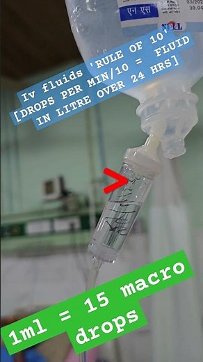 IV FLUIDs drop calculation