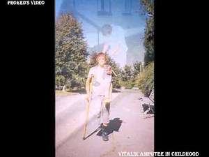 Vitalik amputee in his childhood