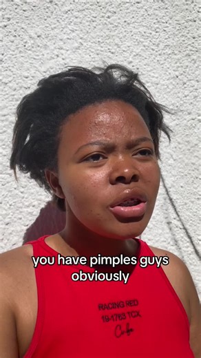 Leave me and my acne alone #fyp #acneskin #relatable #mphorose #viral_video_tiktok #algorithm #foryoupage #genz #genalpha #selflovejourney