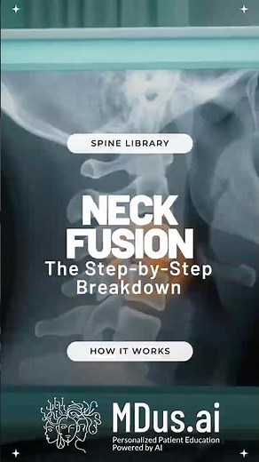 How ACDF Surgery Restores Your Neck