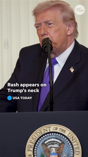Images taken during Medal of Honor ceremony appeared to show a rash behind President Donald Trump’s ear. His doctor weighed in. | USA TODAY