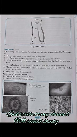 Class 12 Biology practical B Experiment no.12 To identify common disease causing organisms like