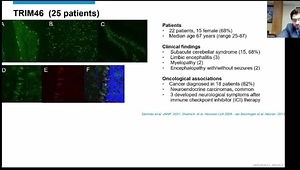 Paraneoplastic Neurological Syndrome: Growing Spectrum and Relevance
