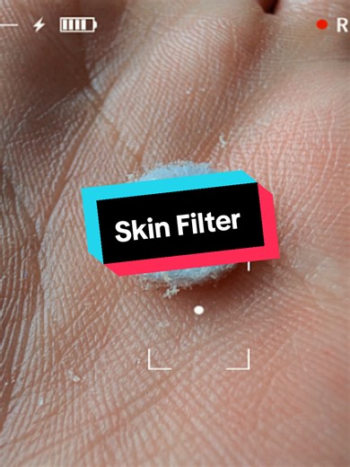 My client = Dry Irritated Dull Skin. I left her with a hydrated smooth radiant glow. The #microdermabrasion facial works wonders: resurfacing, increase blood flow, radiating, lymphatic drainage, increase product intake, blackhead removal, #collagenviral boost ❤️❤️❤️