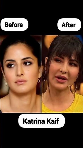 Bollywood actress surgery After Before Look || #bollywood #katrinakaif #fyp #youtubeshorts