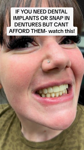 75K views · 333 reactions | You have alternatives when it comes to...