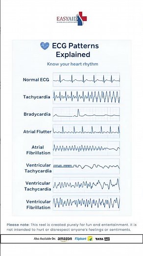 ECG Interpretation Made Simple | Learn Key Heart Rhythm Patterns