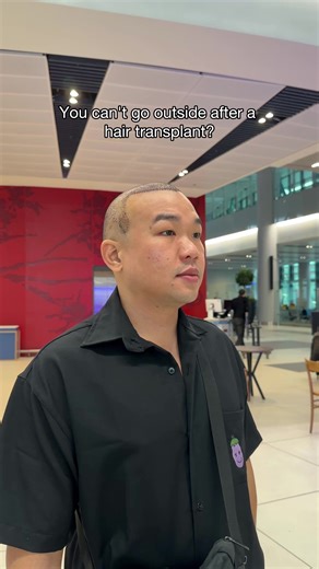 The Impact of Direct Sunlight on Hair Loss