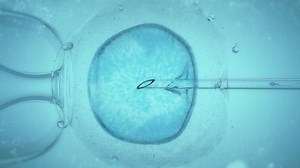 Ivf Vitro Fertilisation Through Microscope Medicine Stock Footage Video (100% Royalty-free) 1016009341 | Shutterstock
