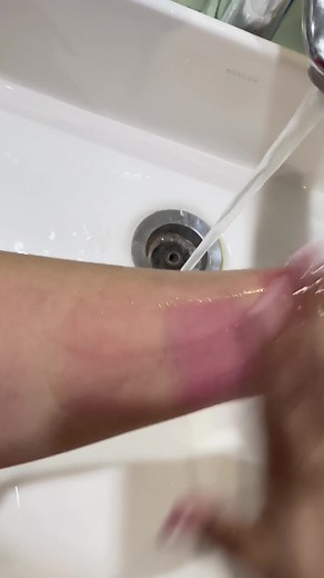 Exploring Skin Aesthetics: Arm Examination and Care