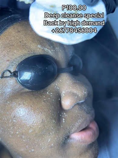 P100.00 deep cleanse special back by high demand 26778456004 Gaborone |Palapye |Francistown #tiktokbotswana🇧🇼tiktoksouthafrica🇿🇦 #tiktokfamous #fypシ゚ #fathersdayspatreat #fyoupage