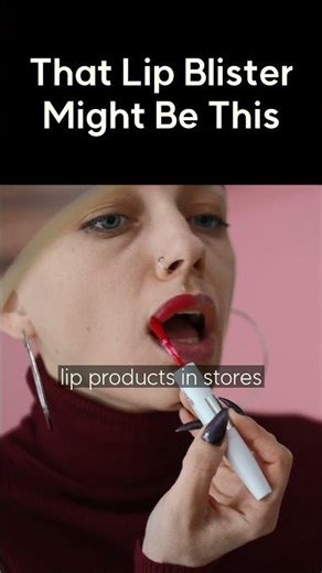 That Lip Blister Might Be This.