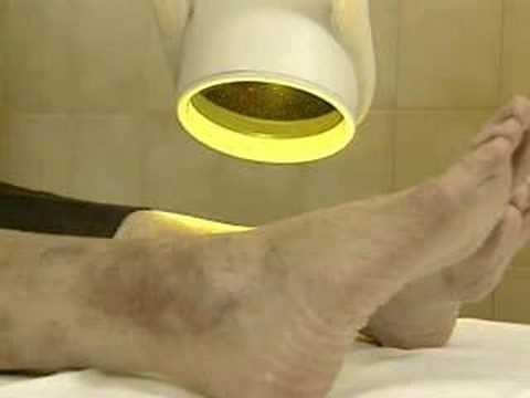 Healing Quest: Bioptron Polarized Light Therapy