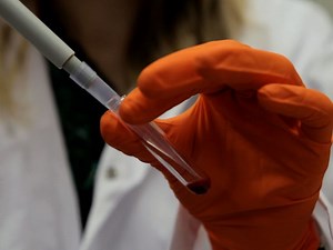 Methods for Quantitative Detection of Antibody-induced Complement Activation on Red Blood Cells