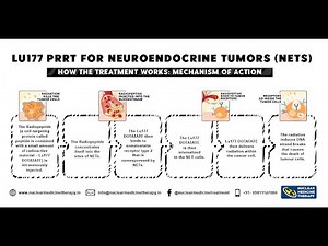 Lu177 PRRT For Neuroendocrine Tumors Nets