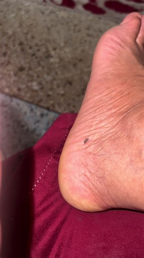 midlifecrisis (@midlifecrisis.40)’s video of insects