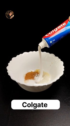 Home Remedy to Reduce Tooth Cavity & Tooth Pain Naturally | Fast Relief