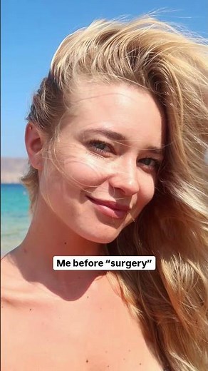 They Said I Got Surgery 😳 Nope!