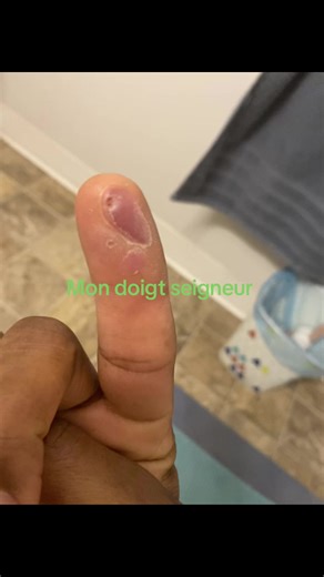 Constant Pierre 🇭🇹 & 🇨🇦 (@constantpierre1)’s videos with 2 Little 2 Late - Levi & Mario