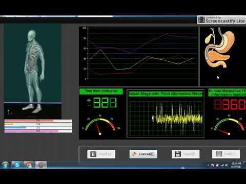How to read reports | Quantum resonance magnetic analyzer | Part-1