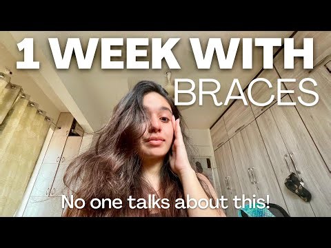 First Week With Braces: Pain, Food, Talking & Mental Health
